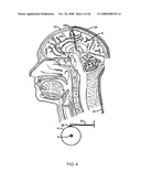 METHODS AND DEVICE TO NEUTRALIZE SOLUBLE TOXIC AGENTS IN THE BRAIN diagram and image