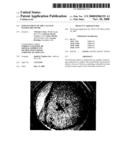 Enhancement Of The Calcium Sensing Receptor diagram and image