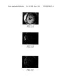 Enhancement Of The Calcium Sensing Receptor diagram and image