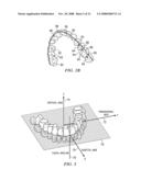 METHOD AND SYSTEM FOR ENHANCED ORTHODONTIC TREARMENT PLENNING diagram and image