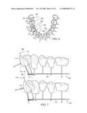 METHOD AND SYSTEM FOR ENHANCED ORTHODONTIC TREARMENT PLENNING diagram and image