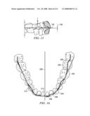 METHOD AND SYSTEM FOR ENHANCED ORTHODONTIC TREARMENT PLENNING diagram and image