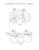 METHOD AND SYSTEM FOR ENHANCED ORTHODONTIC TREARMENT PLENNING diagram and image