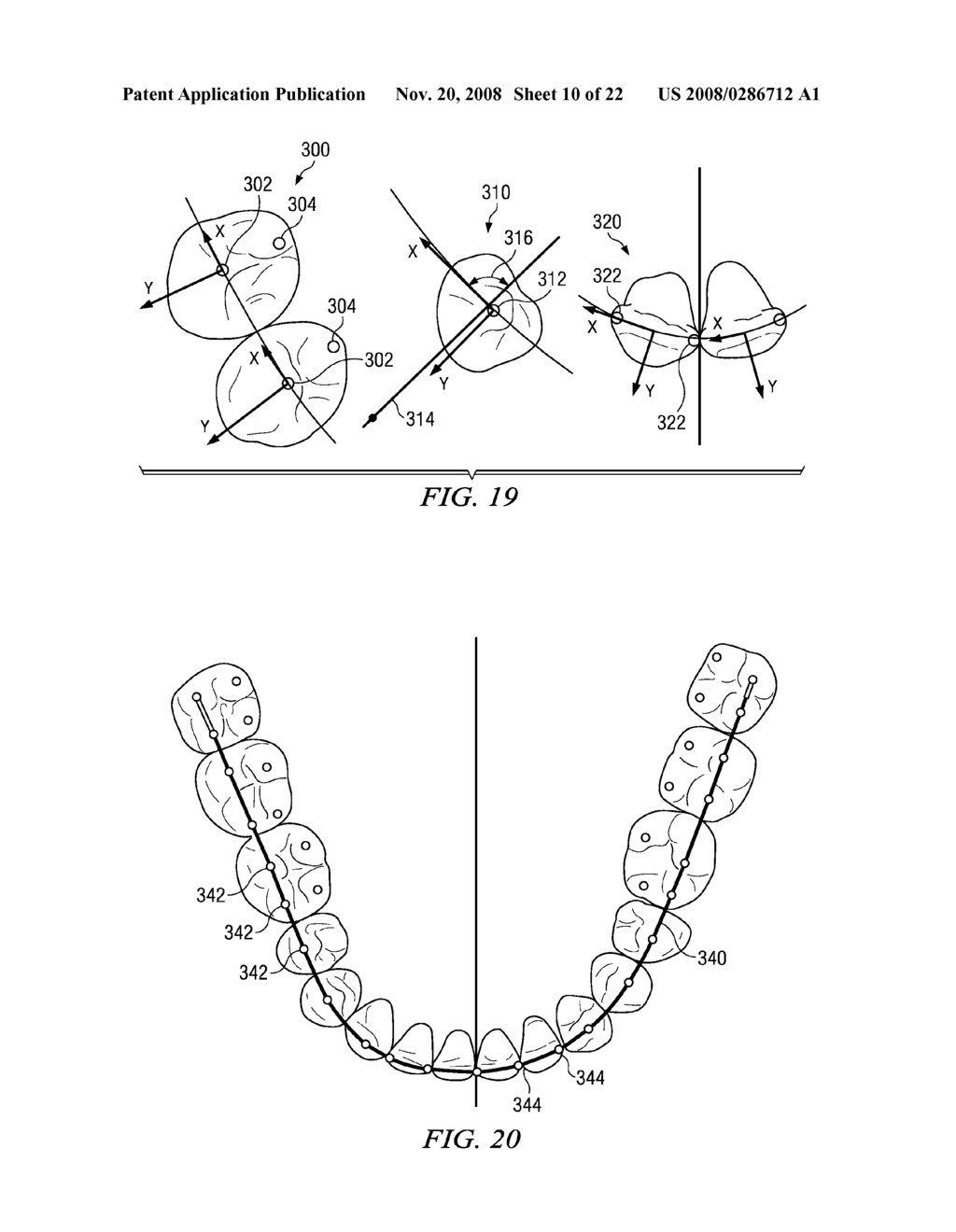 METHOD AND SYSTEM FOR ENHANCED ORTHODONTIC TREARMENT PLENNING - diagram, schematic, and image 11