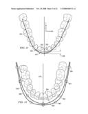 METHOD AND SYSTEM FOR ENHANCED ORTHODONTIC TREARMENT PLENNING diagram and image