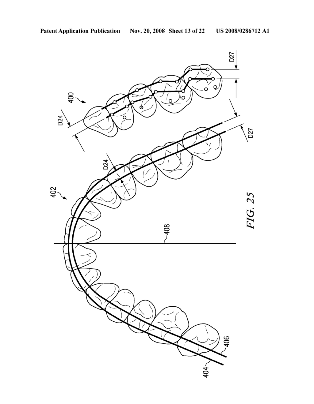 METHOD AND SYSTEM FOR ENHANCED ORTHODONTIC TREARMENT PLENNING - diagram, schematic, and image 14