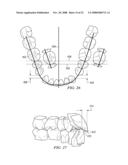 METHOD AND SYSTEM FOR ENHANCED ORTHODONTIC TREARMENT PLENNING diagram and image