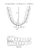 METHOD AND SYSTEM FOR ENHANCED ORTHODONTIC TREARMENT PLENNING diagram and image