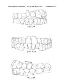 METHOD AND SYSTEM FOR ENHANCED ORTHODONTIC TREARMENT PLENNING diagram and image