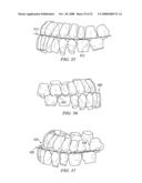 METHOD AND SYSTEM FOR ENHANCED ORTHODONTIC TREARMENT PLENNING diagram and image