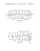 METHOD AND SYSTEM FOR ENHANCED ORTHODONTIC TREARMENT PLENNING diagram and image