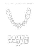 METHOD AND SYSTEM FOR ENHANCED ORTHODONTIC TREARMENT PLENNING diagram and image