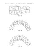 METHOD AND SYSTEM FOR ENHANCED ORTHODONTIC TREARMENT PLENNING diagram and image