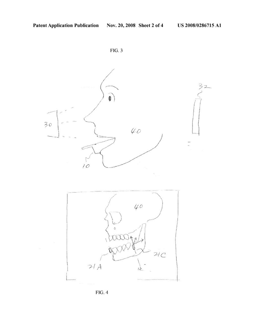 SYSTEM AND METHOD FOR PROVIDING AN IMAGE GUIDED IMPLANT SURGICAL GUIDE - diagram, schematic, and image 03