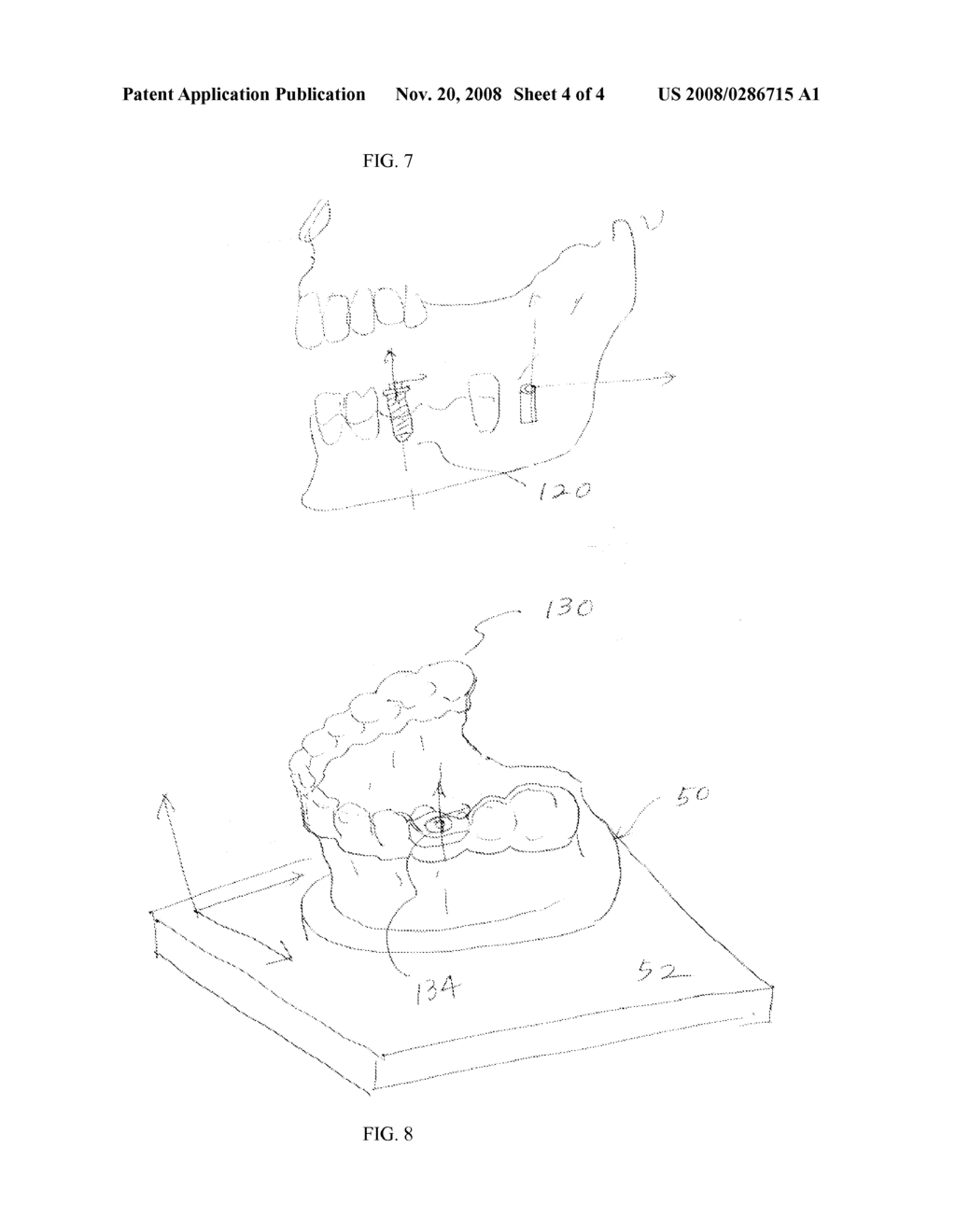 SYSTEM AND METHOD FOR PROVIDING AN IMAGE GUIDED IMPLANT SURGICAL GUIDE - diagram, schematic, and image 05