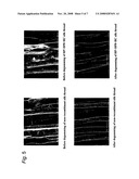 Silk Thread Containing Spider Thread Protein and Silk Worm Producing the Silk Thread diagram and image