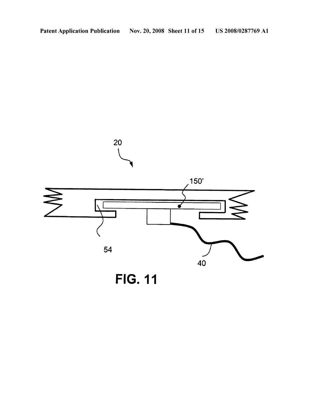 GARMENT ACCESSORY WITH ELECTROCARDIOGRAM SENSORS - diagram, schematic, and image 12