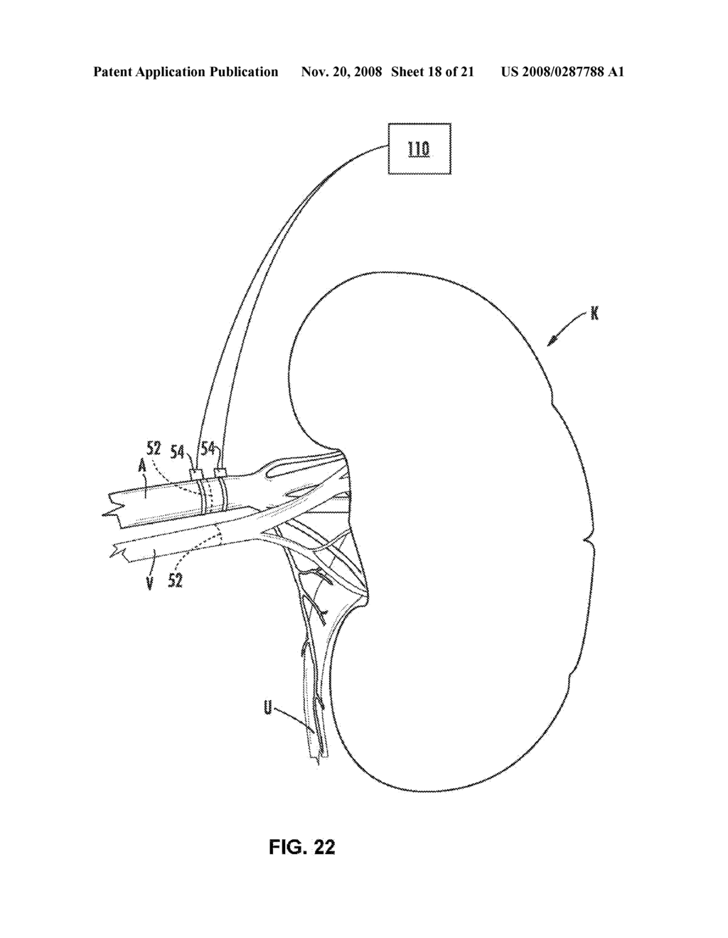 SYSTEMS AND METHODS FOR ORGAN MONITORING - diagram, schematic, and image 19