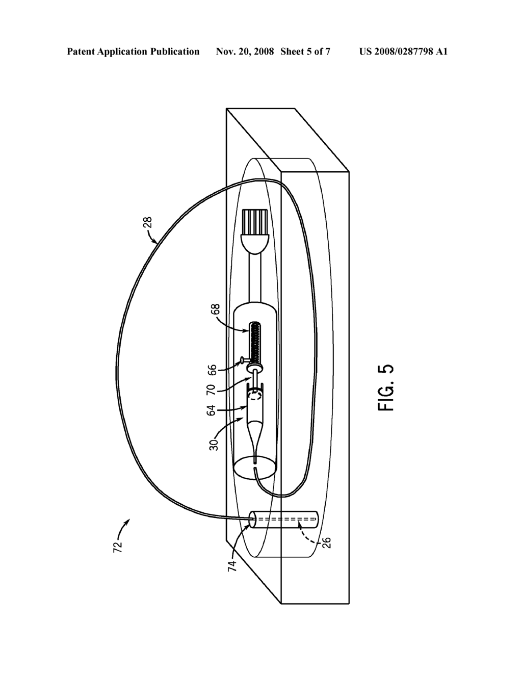 PACKAGING AND FLUID FILLING OF ULTRASOUND IMAGING CATHETERS - diagram, schematic, and image 06