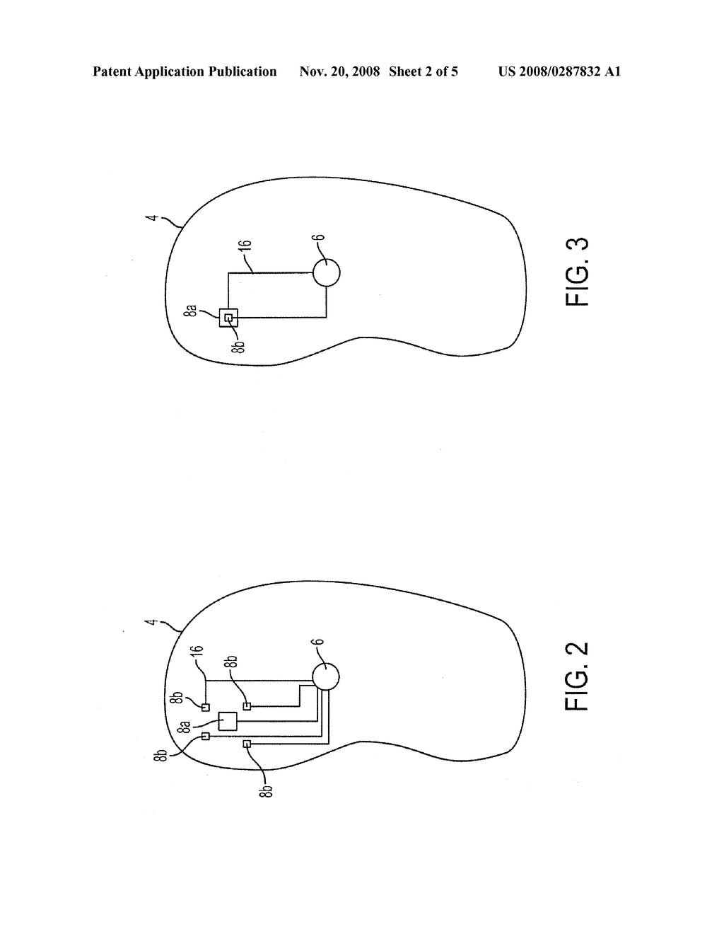 FOOT PRESSURE ALERT AND SENSING SYSTEM - diagram, schematic, and image 03