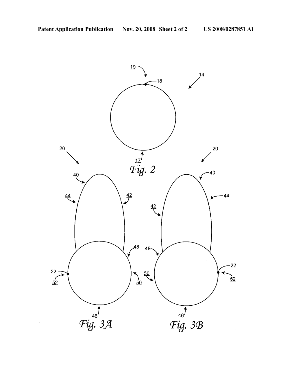 FLEXIBLE TETHER MEMBER CONNECTING A KNEE BRACE TO A BOOT - diagram, schematic, and image 03