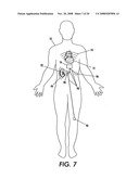 Process and apparatus for treating biological organisms diagram and image