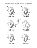 Process and apparatus for treating biological organisms diagram and image