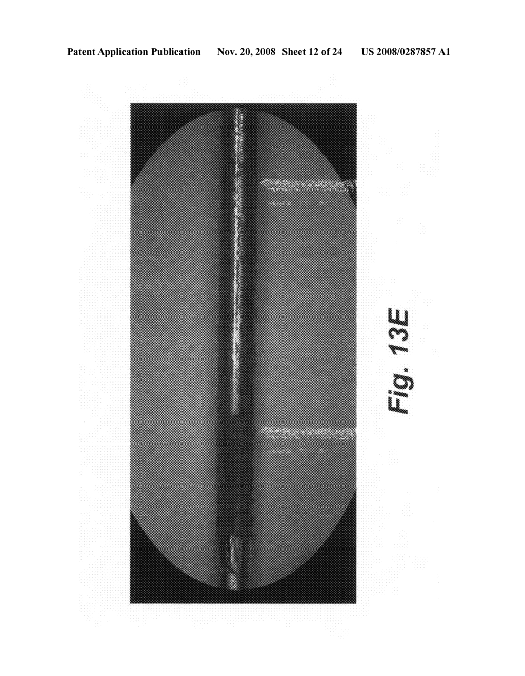 Device and method for single-needle in vivo electroporation - diagram, schematic, and image 13