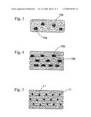 Absorbent Article diagram and image