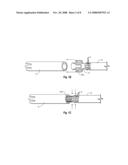 Loading a Tissue Closure Device onto a Delivery Device diagram and image