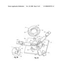 Loading a Tissue Closure Device onto a Delivery Device diagram and image