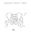 PATIENT-SPECIFIC SURGICAL GUIDANCE TOOL AND METHOD OF USE diagram and image