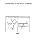 PATIENT-SPECIFIC SURGICAL GUIDANCE TOOL AND METHOD OF USE diagram and image