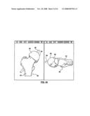 PATIENT-SPECIFIC SURGICAL GUIDANCE TOOL AND METHOD OF USE diagram and image