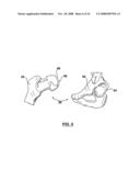 PATIENT-SPECIFIC SURGICAL GUIDANCE TOOL AND METHOD OF USE diagram and image