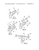 PATIENT-SPECIFIC SURGICAL GUIDANCE TOOL AND METHOD OF USE diagram and image