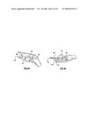 PATIENT-SPECIFIC SURGICAL GUIDANCE TOOL AND METHOD OF USE diagram and image