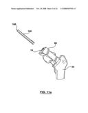 PATIENT-SPECIFIC SURGICAL GUIDANCE TOOL AND METHOD OF USE diagram and image