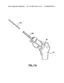 PATIENT-SPECIFIC SURGICAL GUIDANCE TOOL AND METHOD OF USE diagram and image