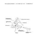 PATIENT-SPECIFIC SURGICAL GUIDANCE TOOL AND METHOD OF USE diagram and image