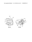 PATIENT-SPECIFIC SURGICAL GUIDANCE TOOL AND METHOD OF USE diagram and image