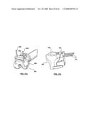 PATIENT-SPECIFIC SURGICAL GUIDANCE TOOL AND METHOD OF USE diagram and image