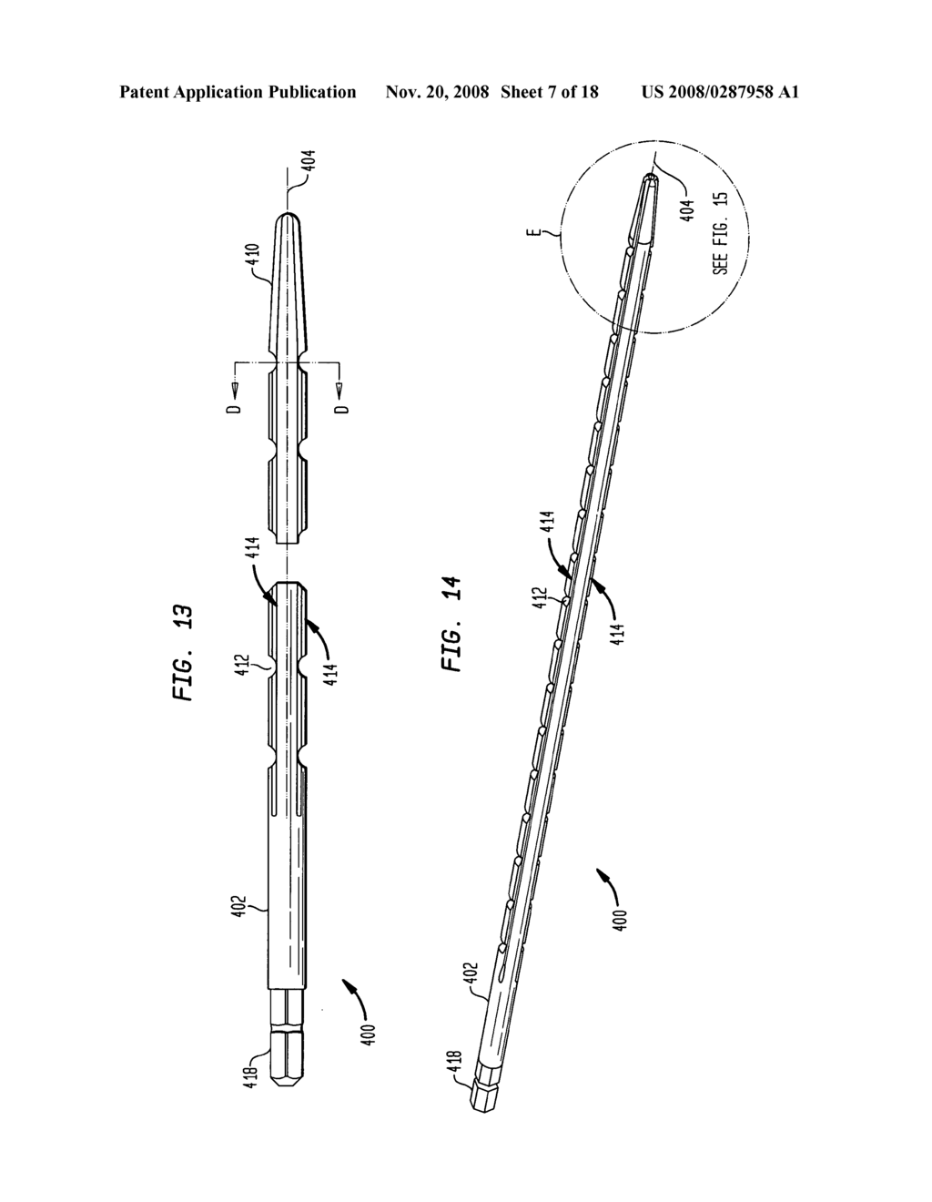 Flexible intramedullary rod - diagram, schematic, and image 08