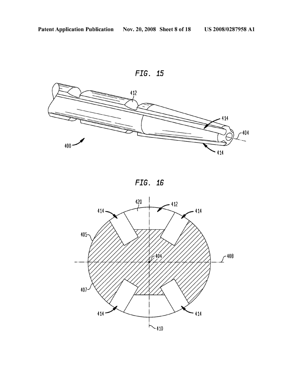 Flexible intramedullary rod - diagram, schematic, and image 09