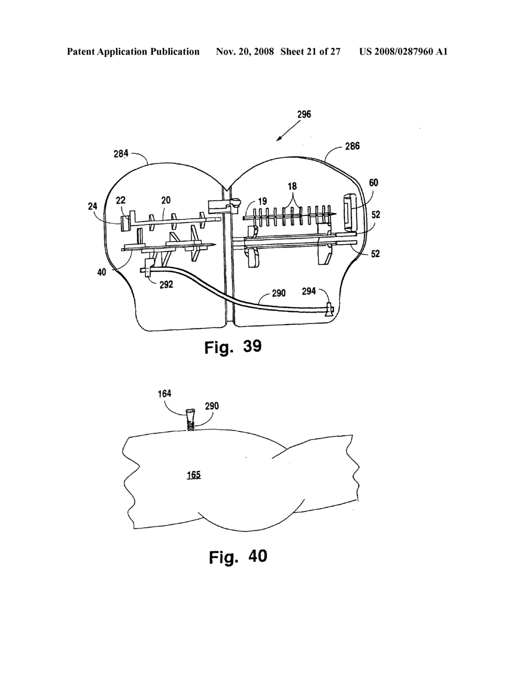 Umbilical cord clamp and cutter - diagram, schematic, and image 22