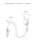 NEEDLE INSTRUMENTS AND IMPLANTABLE SLING ASSEMBLY; KITS COMPRISING THESE COMPONENTS; AND METHODS FOR USE diagram and image