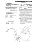 Surgical method for suturing soft tissue to a bone, in particular the rotator cuff to the humerus diagram and image