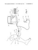 Heat transfer pad having occlusion-resistant ports diagram and image