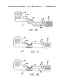 Flexible Circuit Electrode Array with Wire or Film Support diagram and image