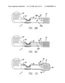 Flexible Circuit Electrode Array with Wire or Film Support diagram and image